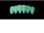 Cod.C14Facing : 10x  wax facings-bridges,  MEDIUM, Overlapping, TOOTH 43-33, compatible with Cod.A14Lingual,TOOTH 43-33 for long-term provisionals preparation